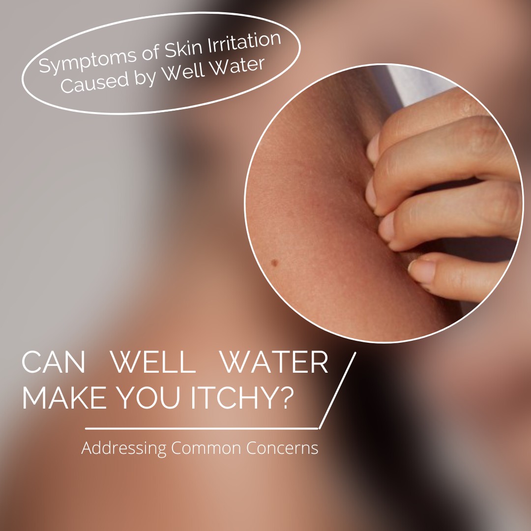 Can Well Water Make You Itchy? – Addressing Common Concerns.